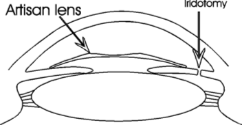 ArtisanPositionDiagram