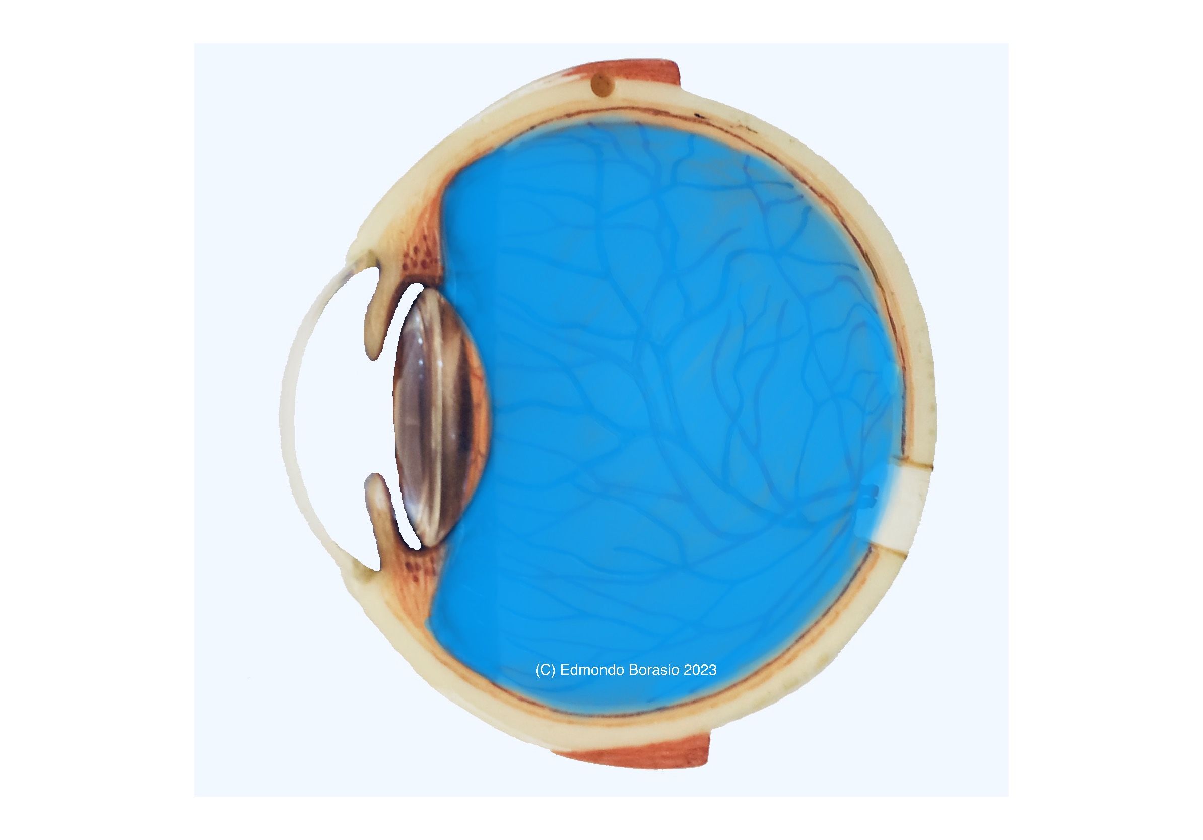 EBorasioDiagramNormalVitreousC