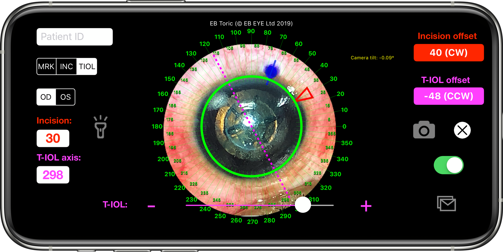 EBtoric(EyeProApp_iOS)